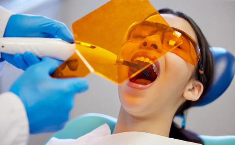 Curing light being used on a filling