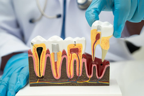 Model of teeth showing root canals