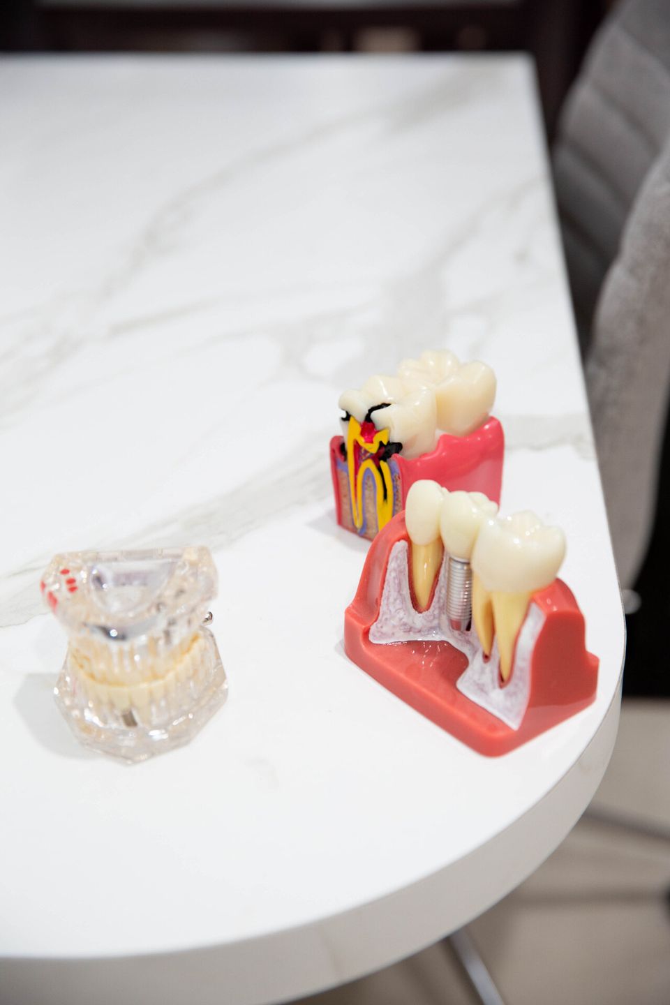 Tooth and jaw models used to explain treatment at Y3 Smiles Dental