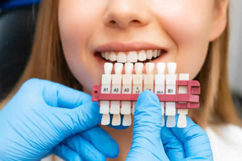 Shade guide held against a patient's teeth