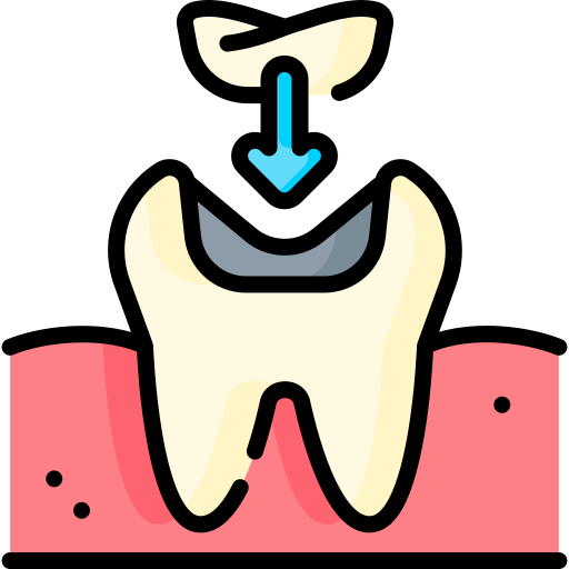 Lost Filling or Crown